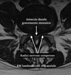 ax-t2-tsp-marelli