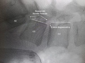 rx-pre-op-crippa